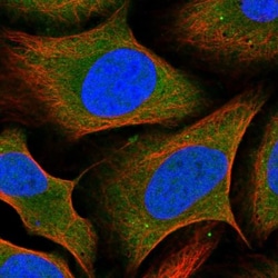 SZRD1 Antibody, Novus Biologicals 25 &mu;L; Unlabeled:Antibodies, Polyclonal